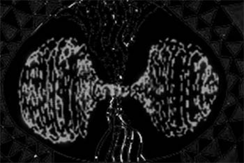 Spirit Coil, Meditation phase