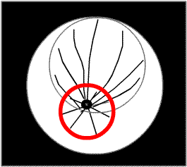 MET bottom